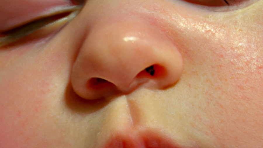 common-rsv-symptoms-in-infants